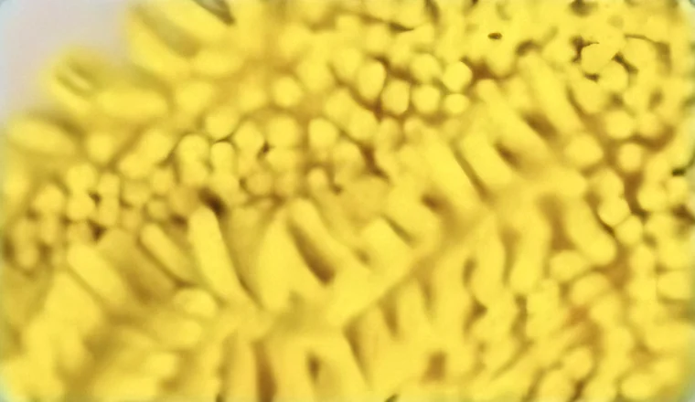 Close-up of the chenille fiber lining