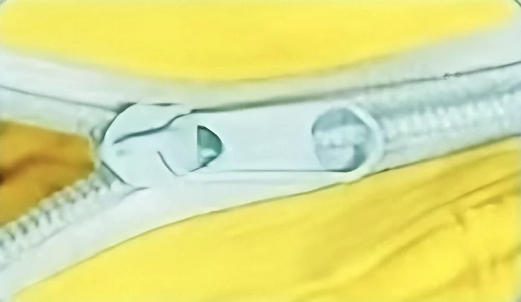 Close-up of the nylon zipper